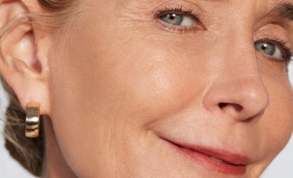 Juvederm Treatment Areas