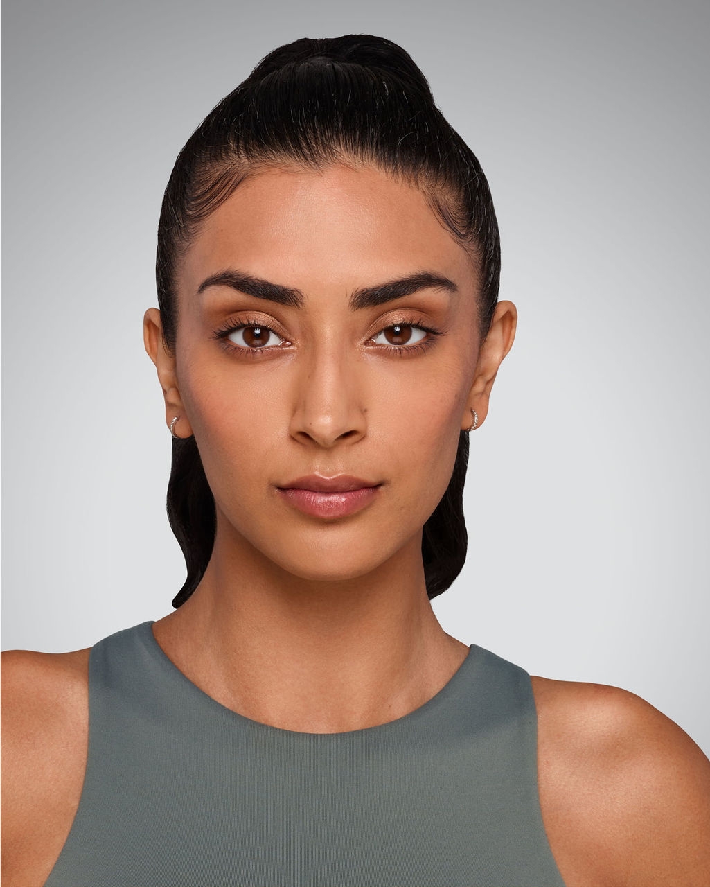 Undereyes - After Juvederm