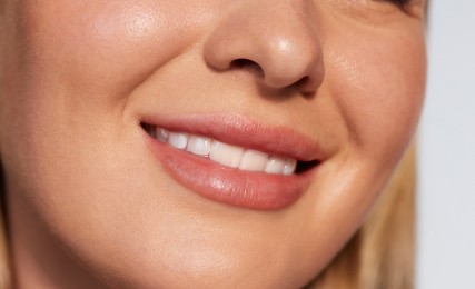 Juvederm Treatment Areas