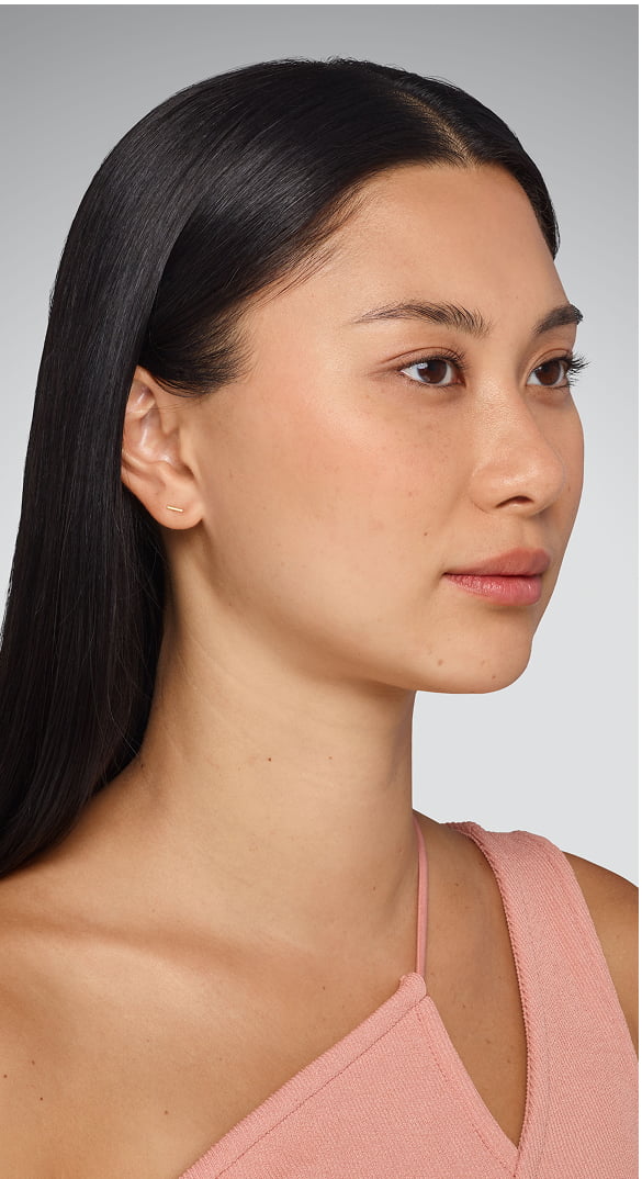 SARA - cheeks, undereye, lips & jawline Before Juvederm