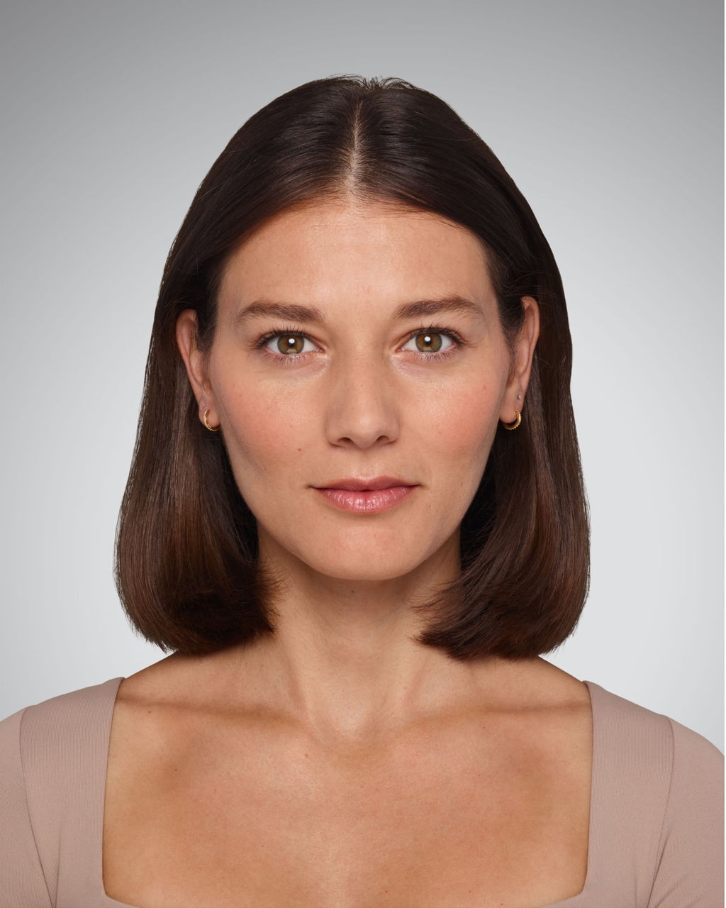 Lips - Before Juvederm