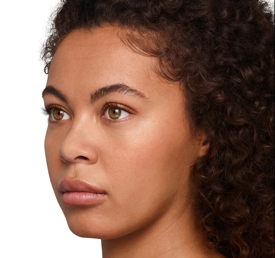 Headshot Jazz - Juvederm Optimize After 1