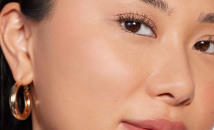 Juvederm Treatment Areas