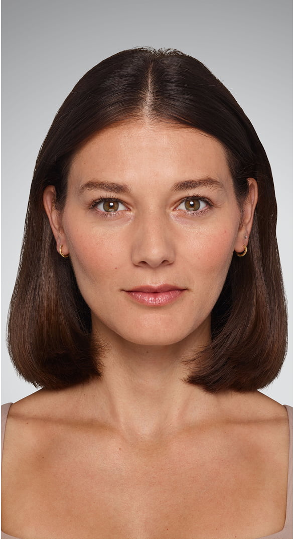 Lips - Before Juvederm