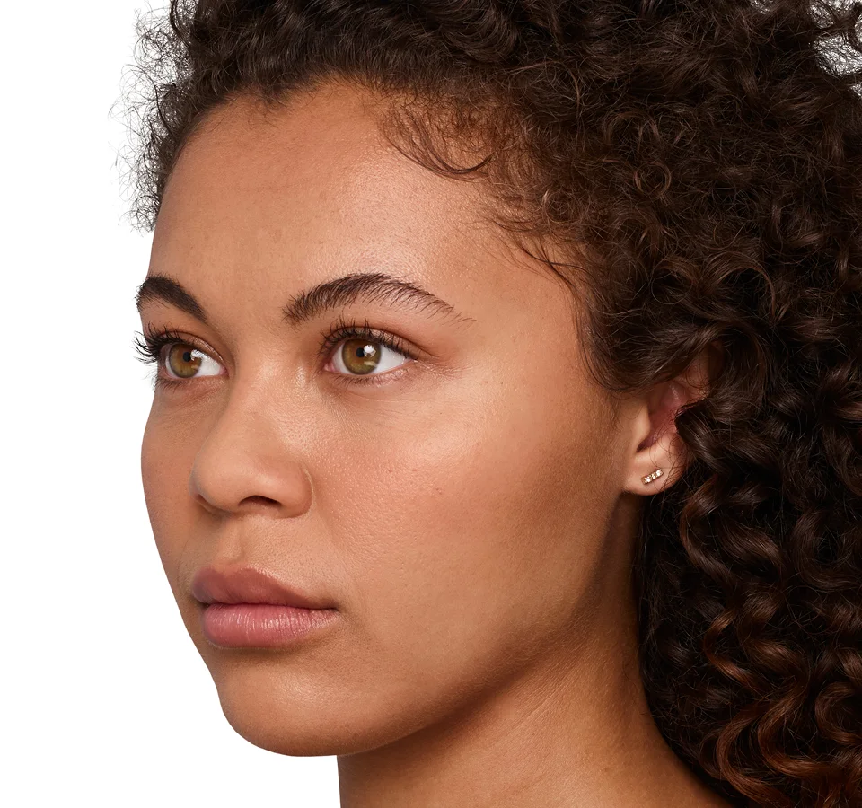 Headshot Jazz - Juvederm Customize After 2