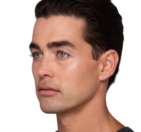 Headshot Sterling- Juvederm Before