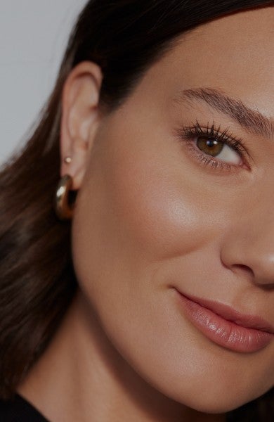Victoria- Juvederm Results