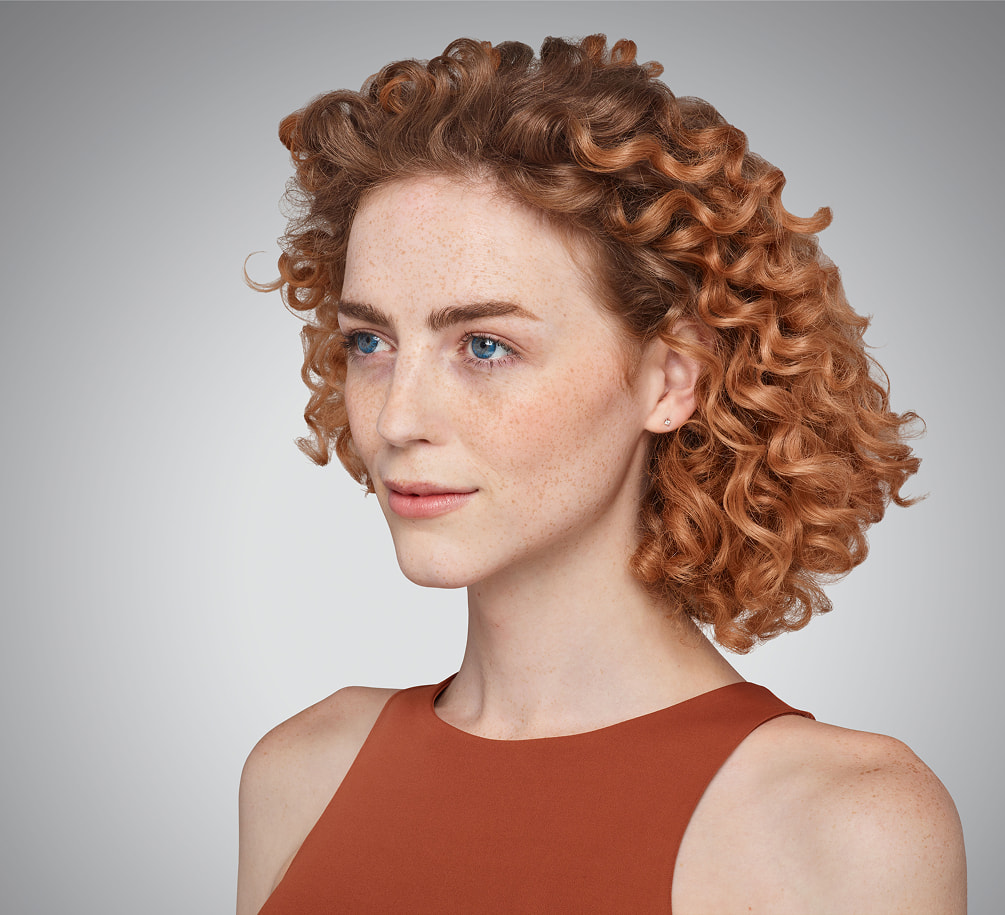 addieson - cheeks, chin, undereye & lips Before Juvederm