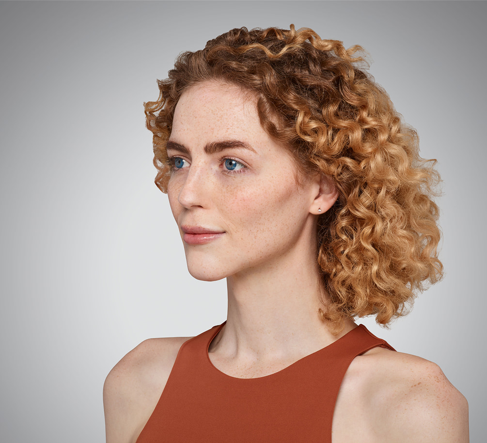 addieson - cheeks, chin, undereye & lips After Juvederm