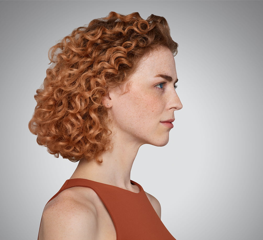 addieson - cheeks, chin, undereye & lips Before Juvederm