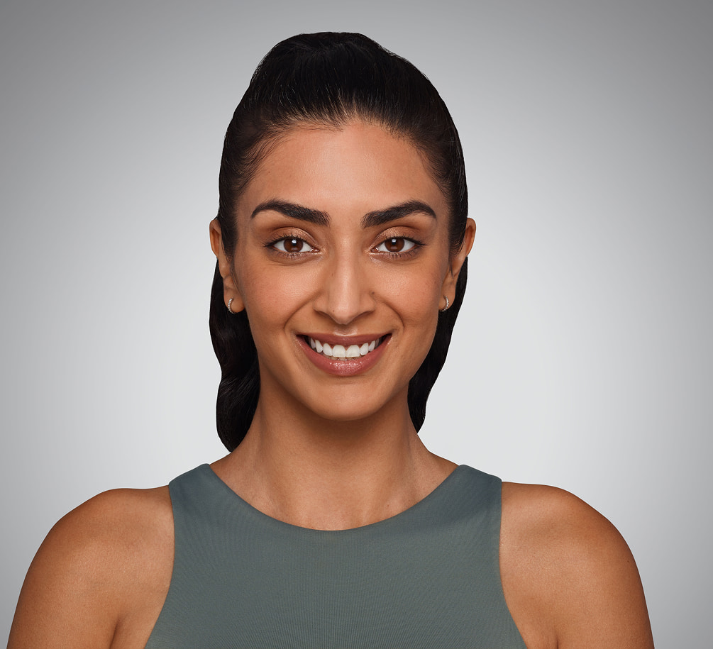 JASKIRAN - cheeks, chin, undereye, lines & lips Before Juvederm