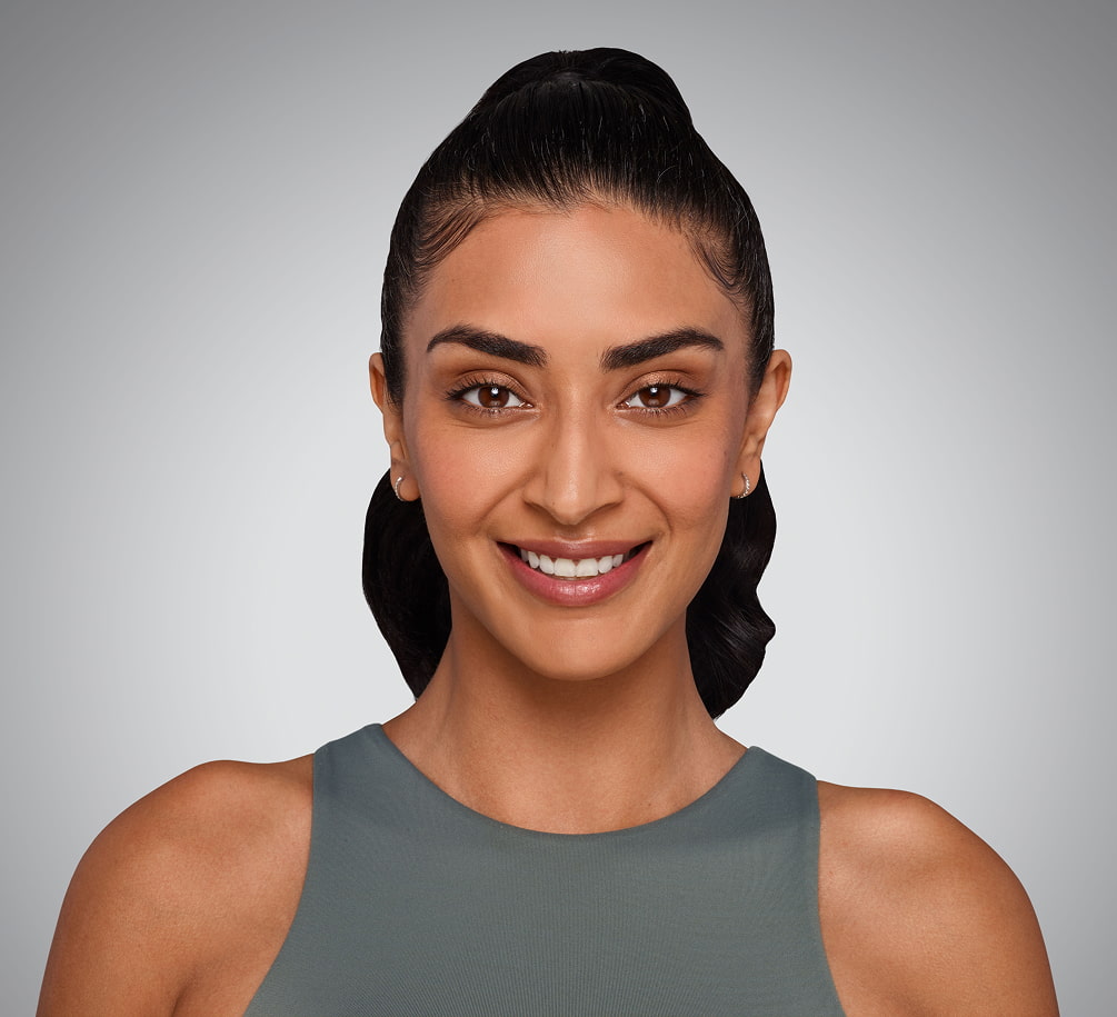 JASKIRAN - cheeks, chin, undereye, lines & lips After Juvederm