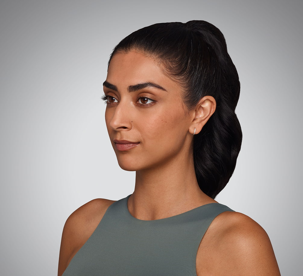 JASKIRAN - cheeks, chin, undereye, lines & lips Before Juvederm