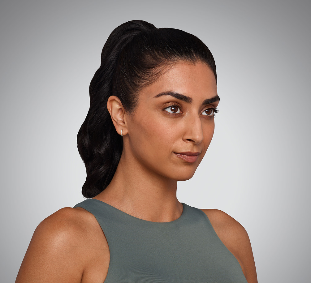 JASKIRAN - cheeks, chin, undereye, lines & lips Before Juvederm
