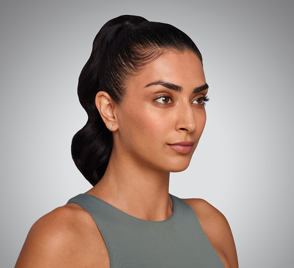 JASKIRAN - cheeks, chin, undereye, lines & lips After Juvederm