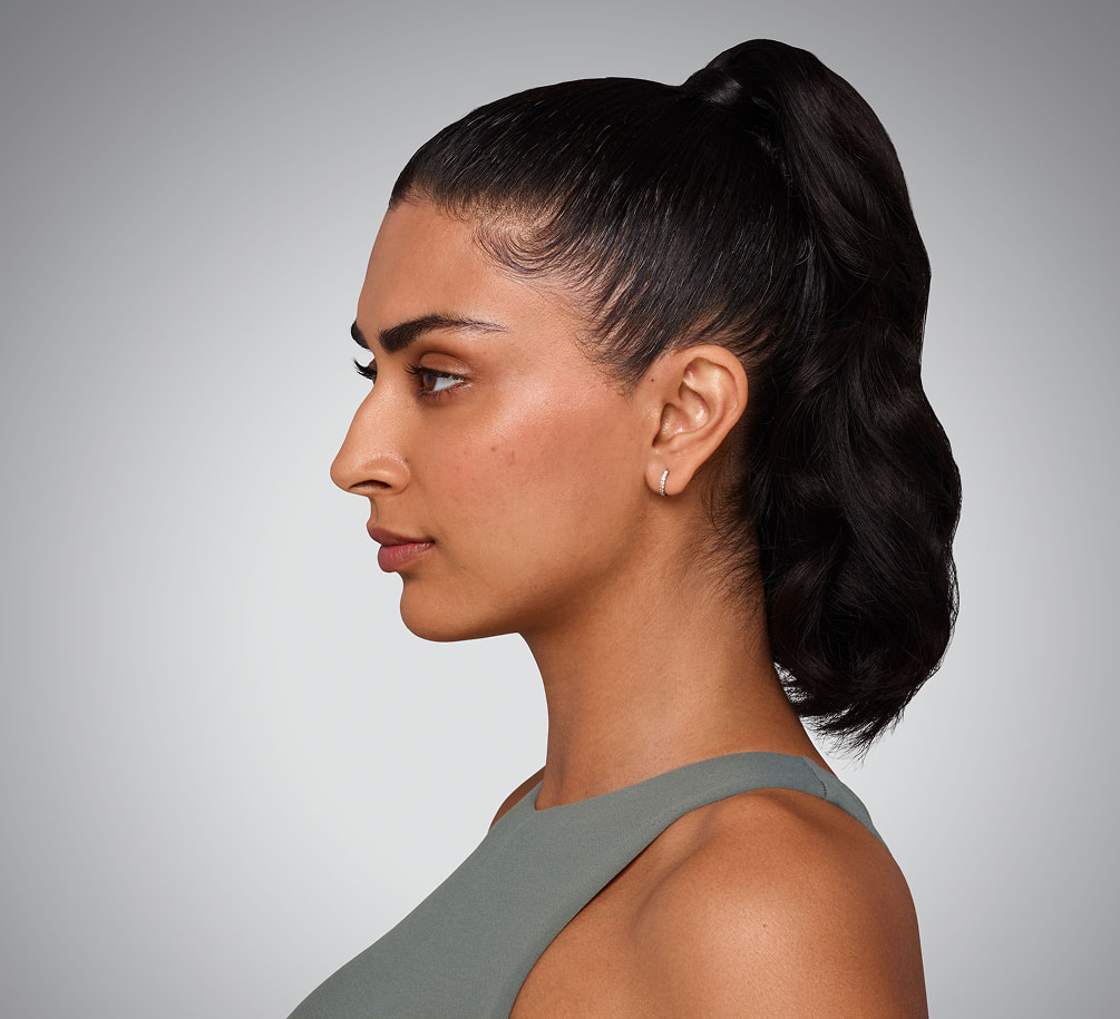 JASKIRAN - cheeks, chin, undereye, lines & lips After Juvederm