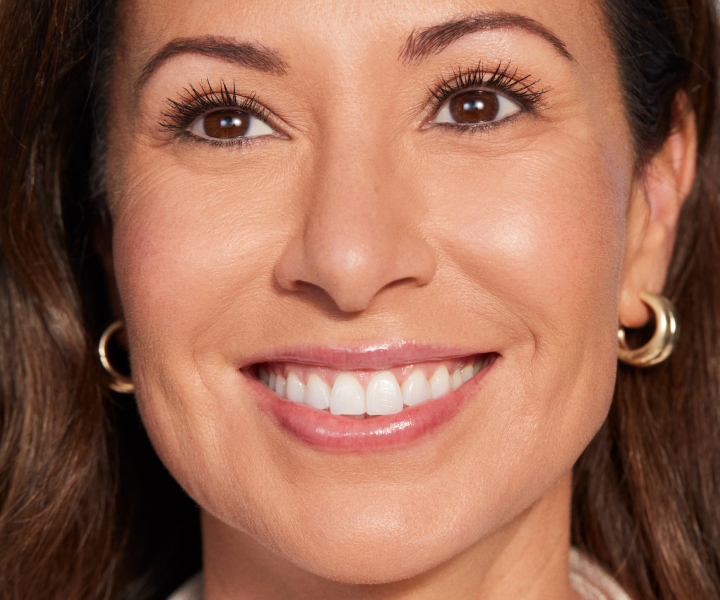 Juvederm Rewards - Smiling