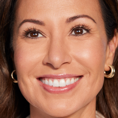 Juvederm Rewards - Smiling